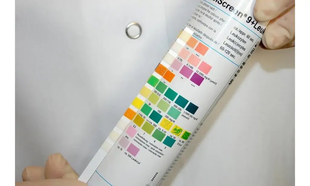 Test e Dispositivi Medici Patologie Urogenitali - Farmacia Dottor Tili